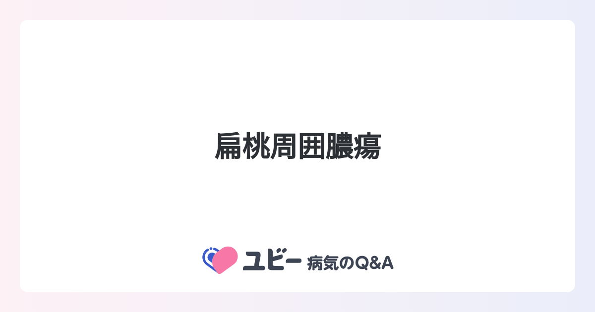 扁桃周囲膿瘍の原因は何ですか?